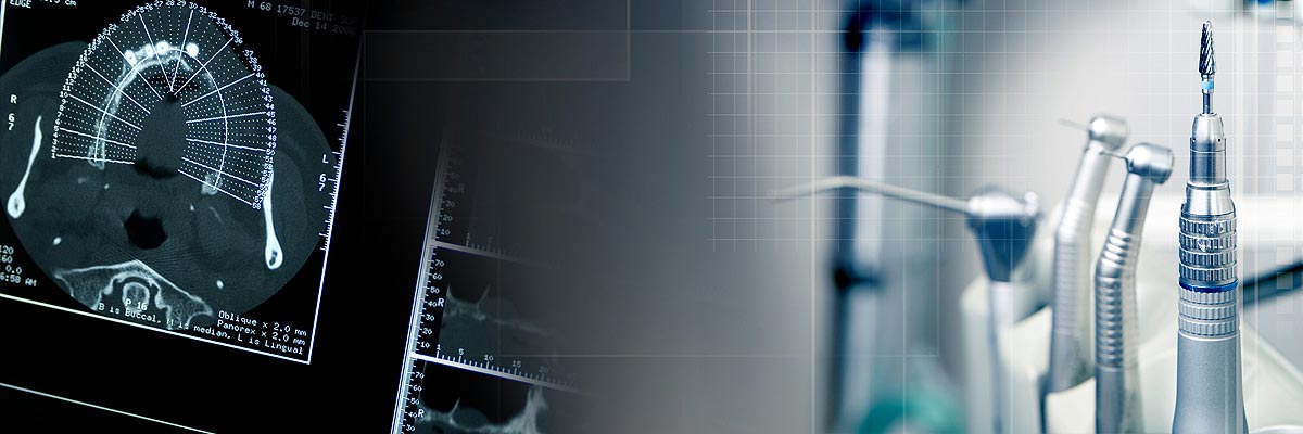 Culver City Will I Need a Bone Graft for Dental Implants?