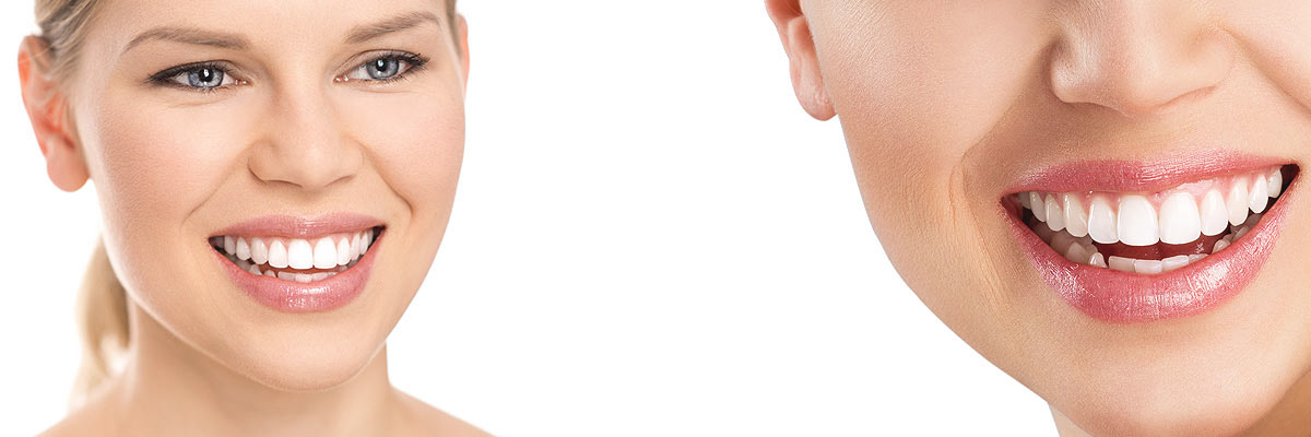 Culver City Cosmetic Dental Care