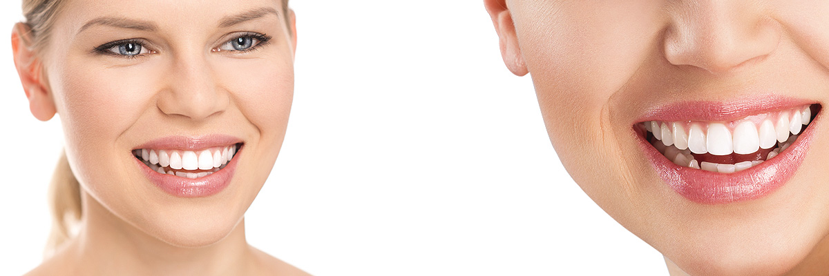 Culver City Cosmetic Dental Services