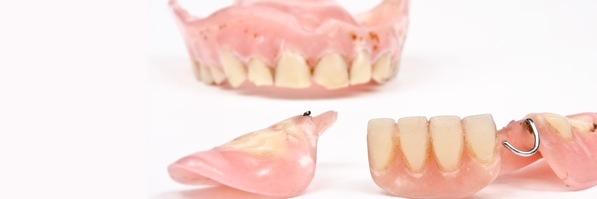 Culver City What Do I Do If I Damage My Dentures?