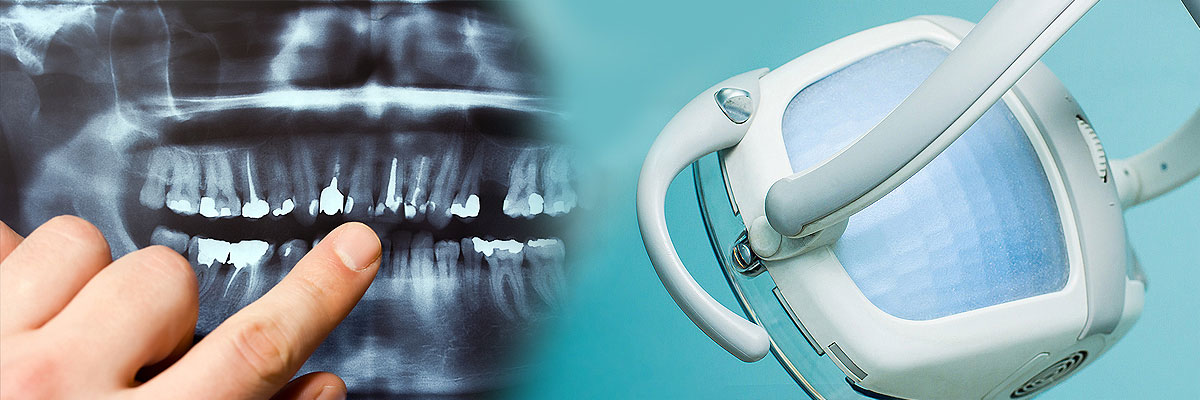 Culver City Dental Cleaning