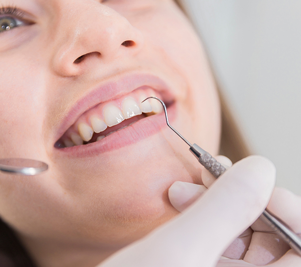 Culver City Dental Cleaning