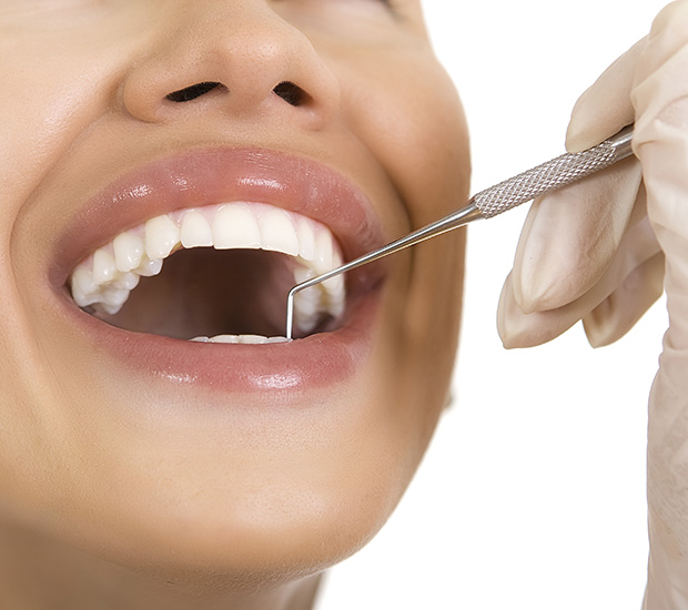 Culver City Dental Restorations