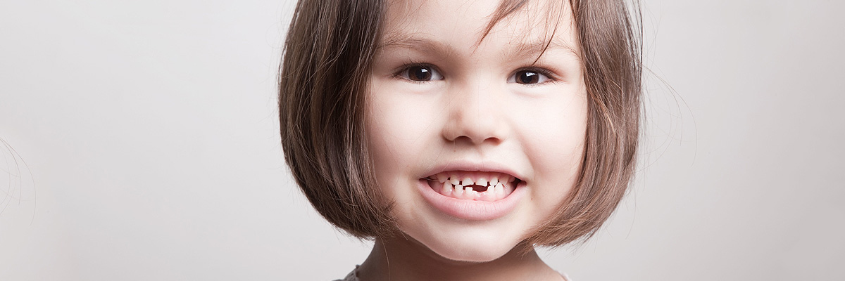 Culver City Dental Restoration