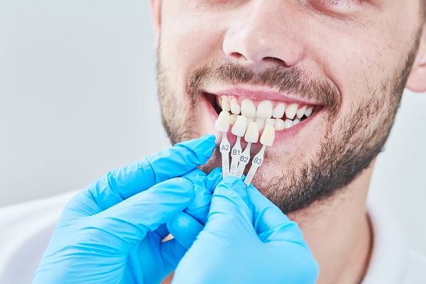 Questions To Ask A Dentist About Dental Veneers