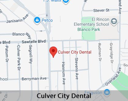 Map image for What Can I Do to Improve My Smile in Culver City, CA
