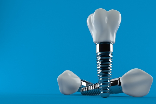 Determining Which Type Of Dental Implant Is Right For You