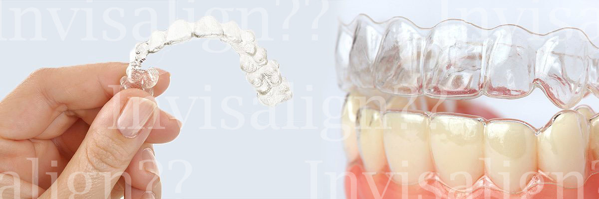 Culver City Does Invisalign® Really Work?