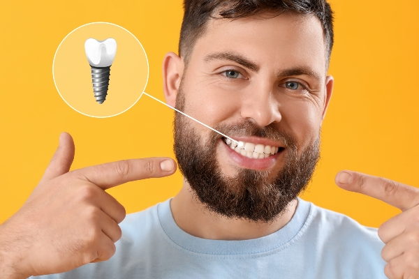 How Dental Implants Support Oral Health