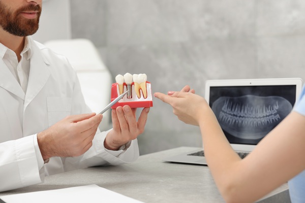 Implant Crown: The Final Step In Restoring Your Smile