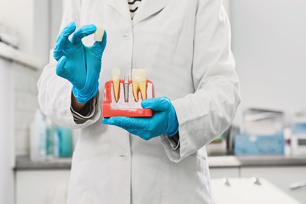 Implant Crowns: A Durable And Natural Looking Solution For Tooth Restoration