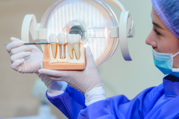 An Overview Of Implant Dentistry Treatment