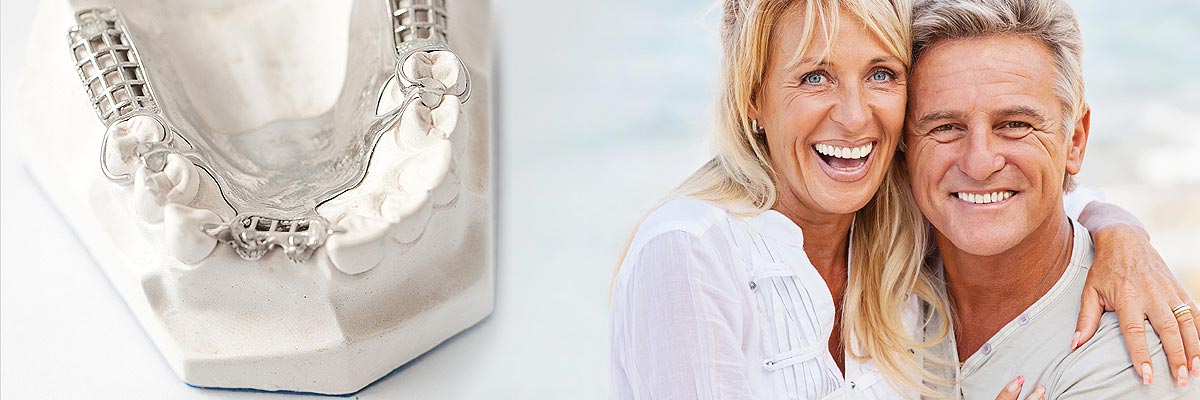 Culver City Implant Supported Dentures