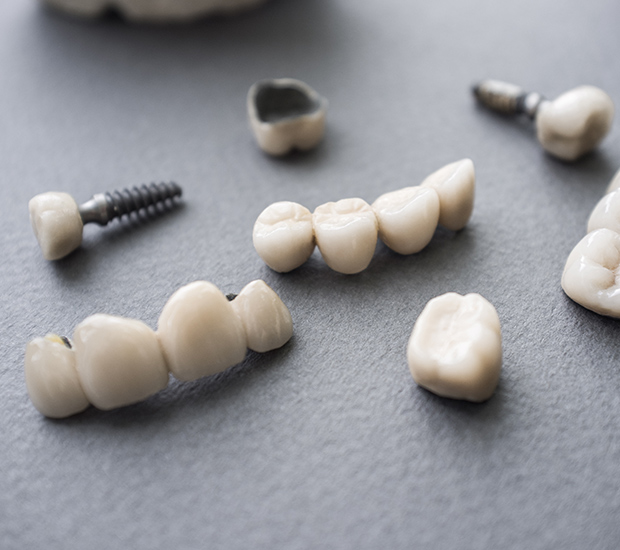 Culver City The Difference Between Dental Implants and Mini Dental Implants