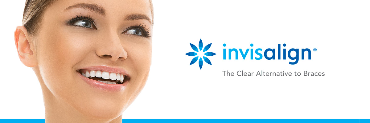 Culver City Invisalign for Teens