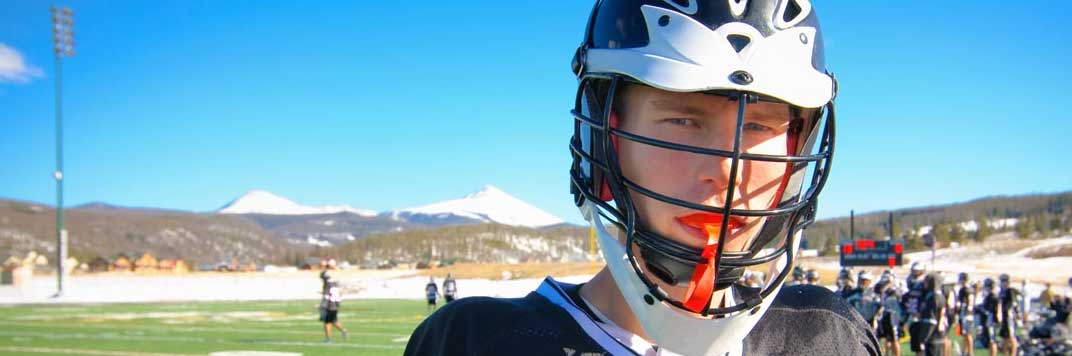 Culver City Mouth Guards