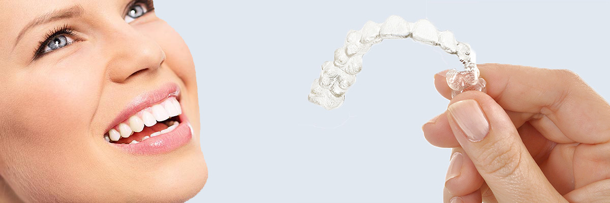 Culver City 7 Things Parents Need to Know About Invisalign Teen
