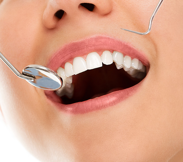 Culver City Periodontics