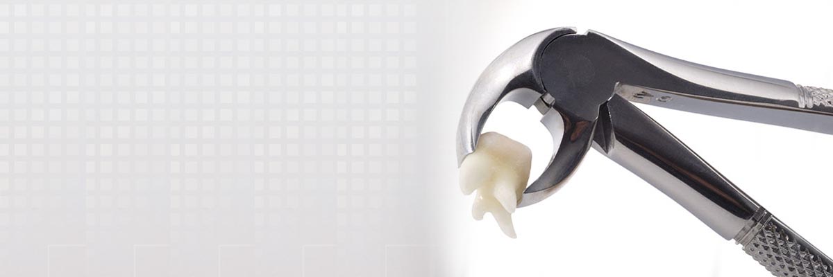 Culver City Tooth Extraction
