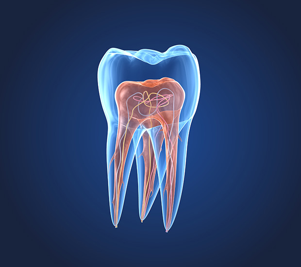 Culver City What is an Endodontist