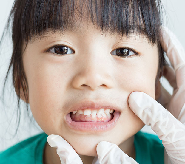 Culver City Why Dental Sealants Play an Important Part in Protecting Your Child's Teeth