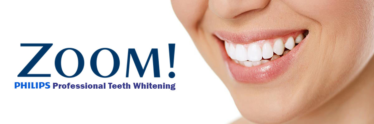 Culver City Zoom Teeth Whitening